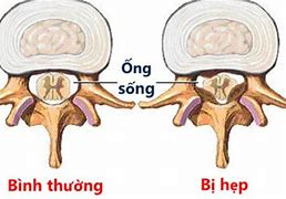 Nhức Chân Từ Đầu Gối Trở Xuống